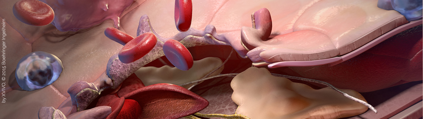 banner AlveolarRepair XVIVO